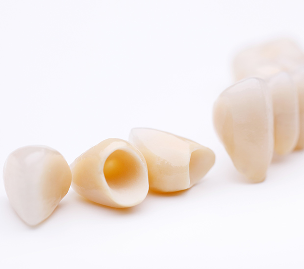 Tucson Dental Crowns