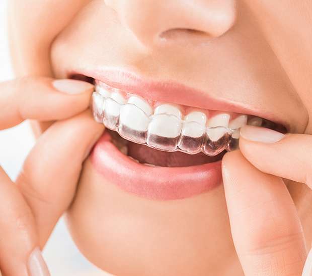 Tucson Does Invisalign® Really Work?
